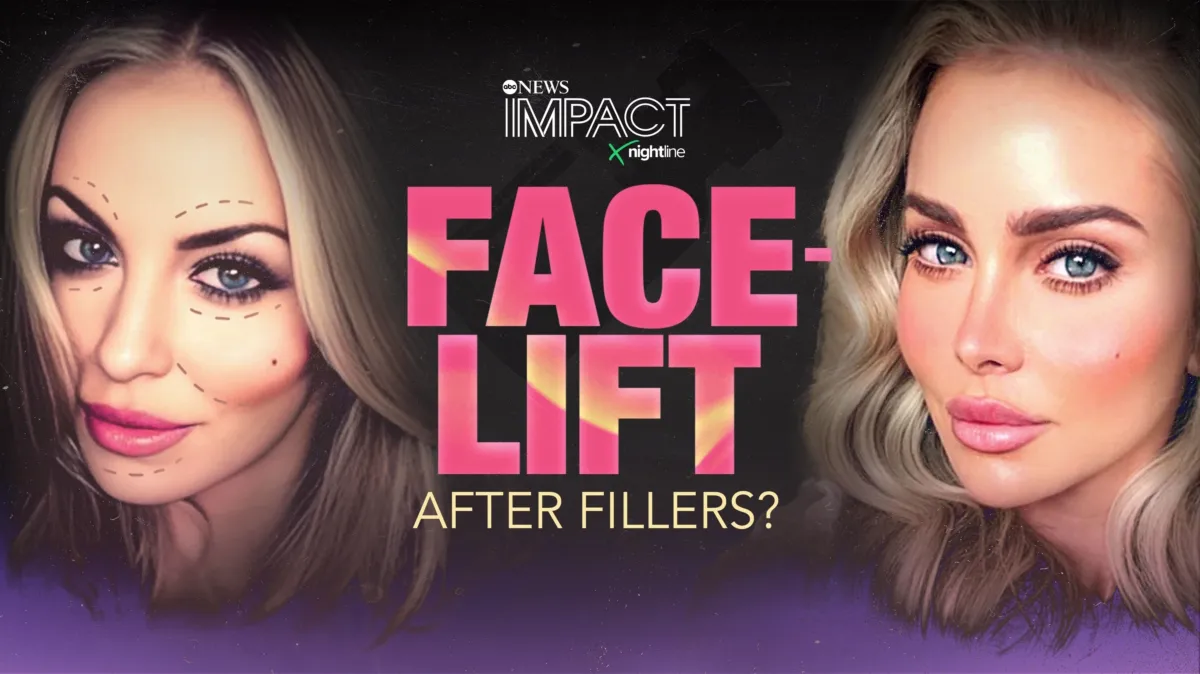 IMPACT x Nightline: Facelift: After Fillers? poster — TV series on Disney+