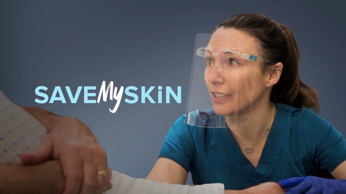 Save My Skin poster — TV series on Disney+